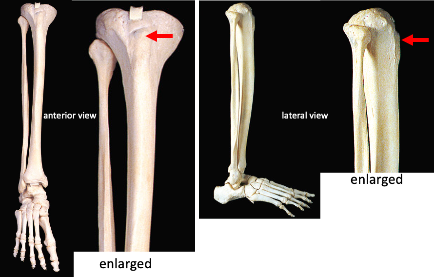 anterior (left) and lateral (right) views of the lower leg, with enlarged insets to show the tibial tuberosity