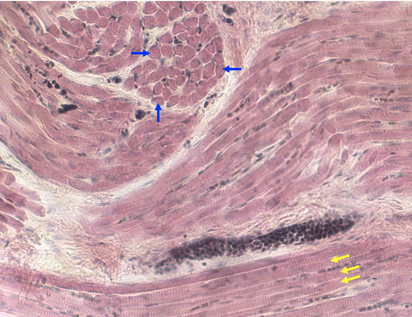 skeletal muscle in the tongue