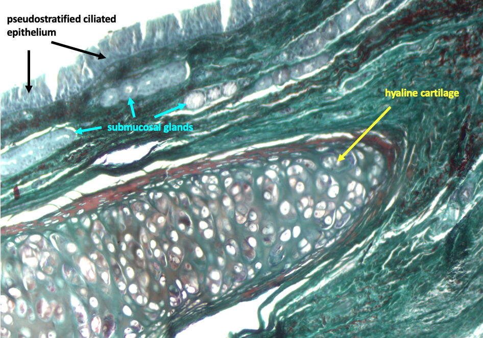 section of trachea showing end of hyaline cartilage ring