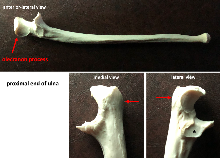 view of the full ulna (top) with enlarged views of the medial (left, bottom) and lateral (right, bottom) sides of the proximal end of the bone