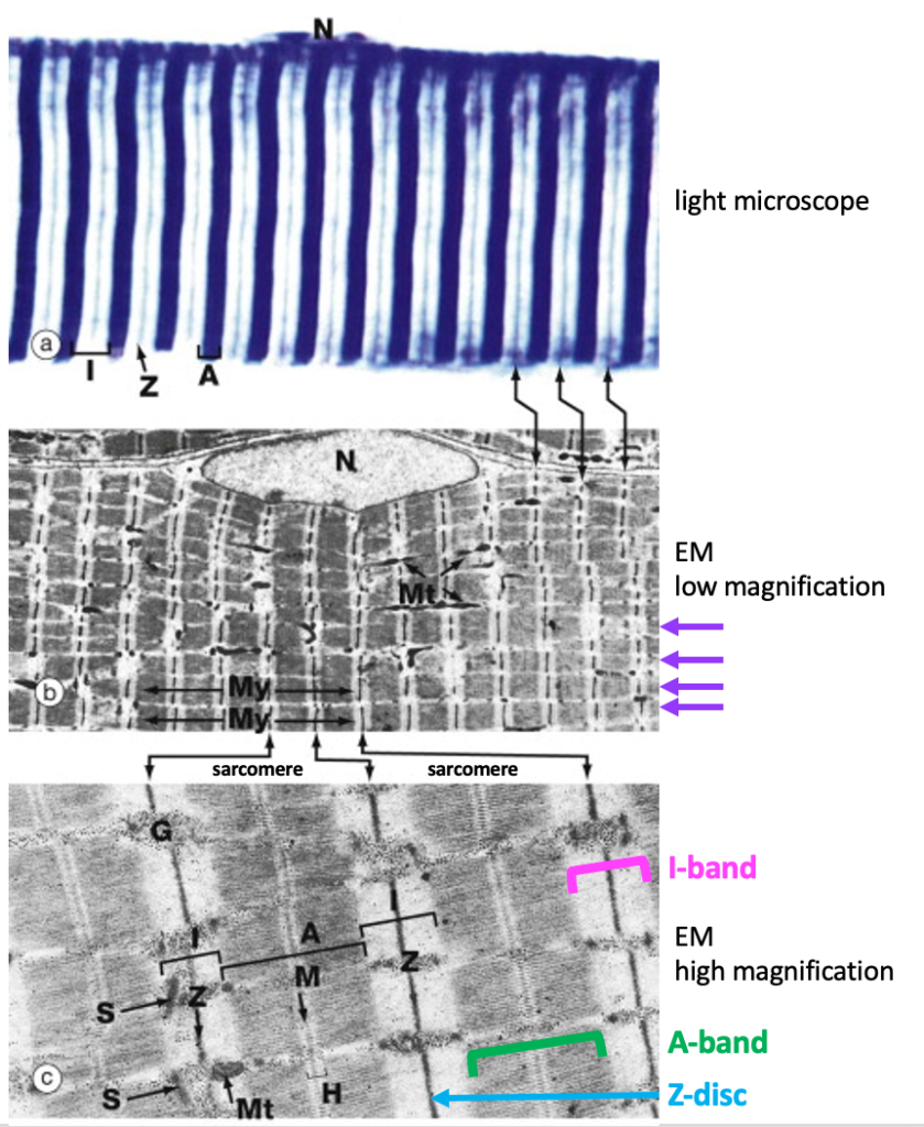 striations, alternating dark and light bands, as seen in the light microscope (top) and EM (middle and bottom)