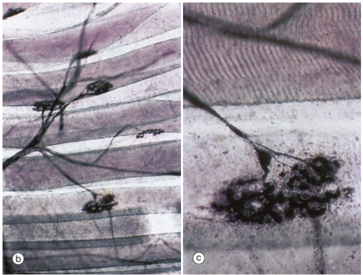 right: a somatic motor neuron branching to form synapses on several muscle fibers; left: high magnification of one synapse