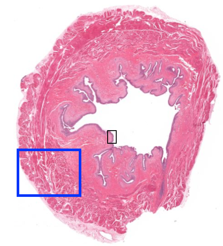 section of bladder at low power indicating region enlarged in subsequent figures