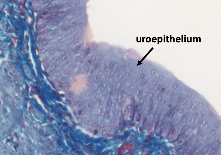 uroepithelium on surface of calyx at high magnification