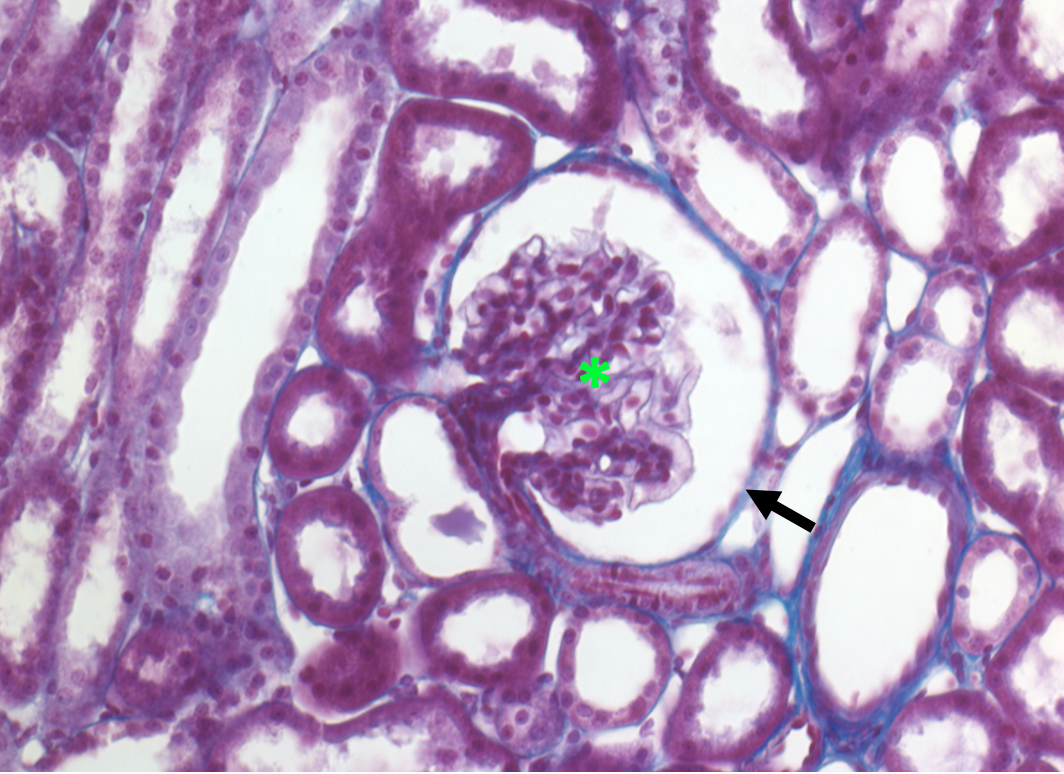 high magnification tissue section of a renal corpuscle; glomerulus indicated by bright green asterisk and outer edge of Bowman's capsule indicated by a black arrow