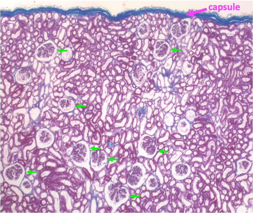 histology section showing the renal cortex at low power; the capsule is at the upper edge and renal corpuscles (green arrows) are scattered within the tissue