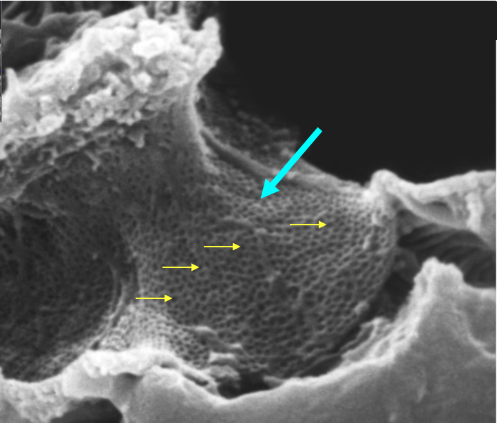 inner surface of a glomerular capillary showing fenestrations in an endothelial cell