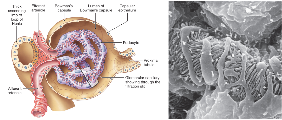illustration of podocytes in a renal corpuscle (left) and a scanning EM of podocytes (right)