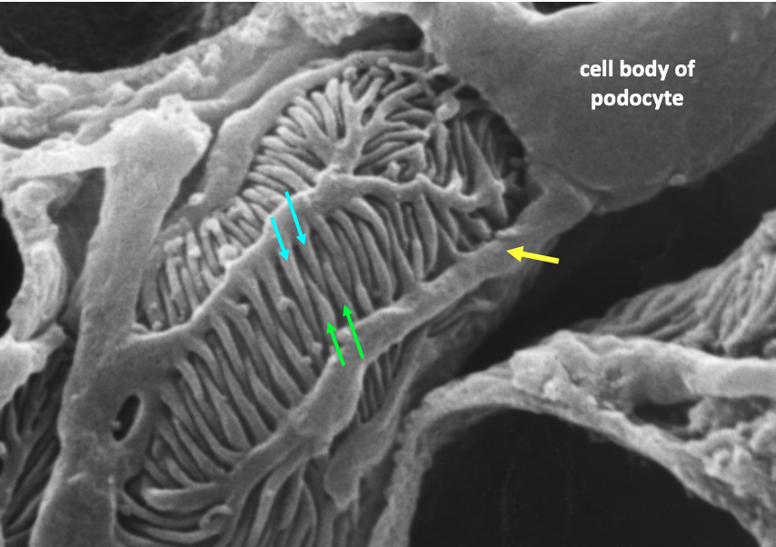 podocytes on the outer surface of a glomerular capillary loop; yellow arrow indicates larger arm while smaller cyan and green arrows indicate foot processes