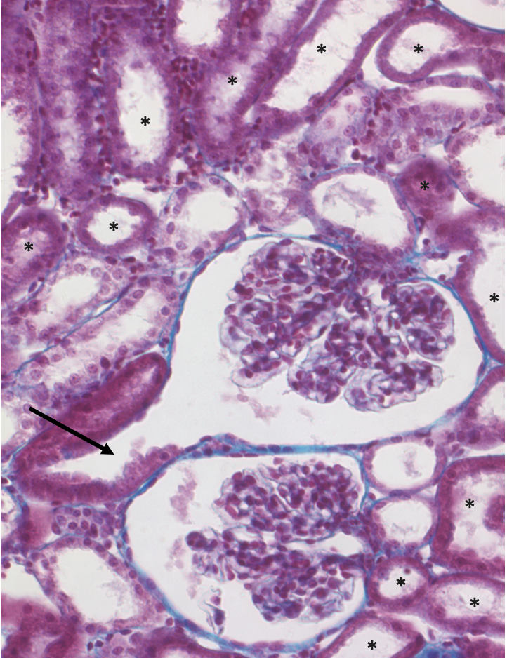 light micrograph of renal cortex showing two renal corpuscles and sections through the renal tubule; proximal tubules are intensely stained and indicated with an arrow (attached to Bowman's space) and asterisks