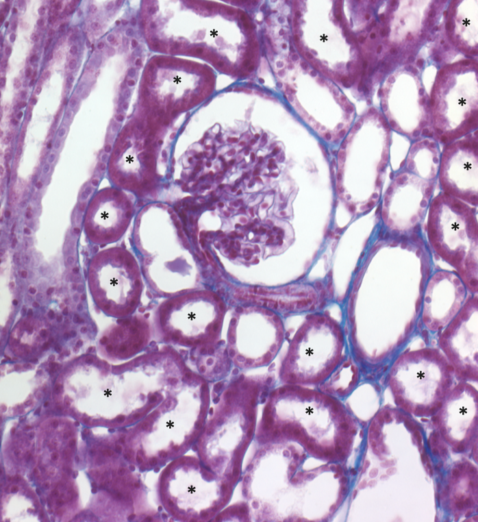 light micrograph with renal corpuscle and surrounding renal tubules; asterisks mark intensely stained proximal tubules