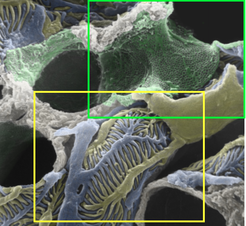 scanning EM of glomerulus pseudo colored to show inside of fenestrated capillary in green and podocytes outside of capillary in yellow and blue