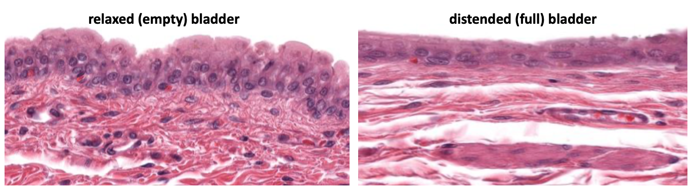 section showing uroepithelium (at top) in relaxed (left) and distended (right) bladder