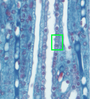 tissue section showing a collecting duct in the center; a green box highlights two cells which are shown schematically in the next figure