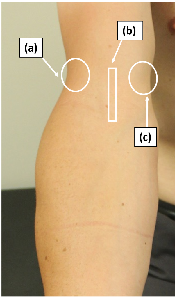 Right elbow – Anterior view