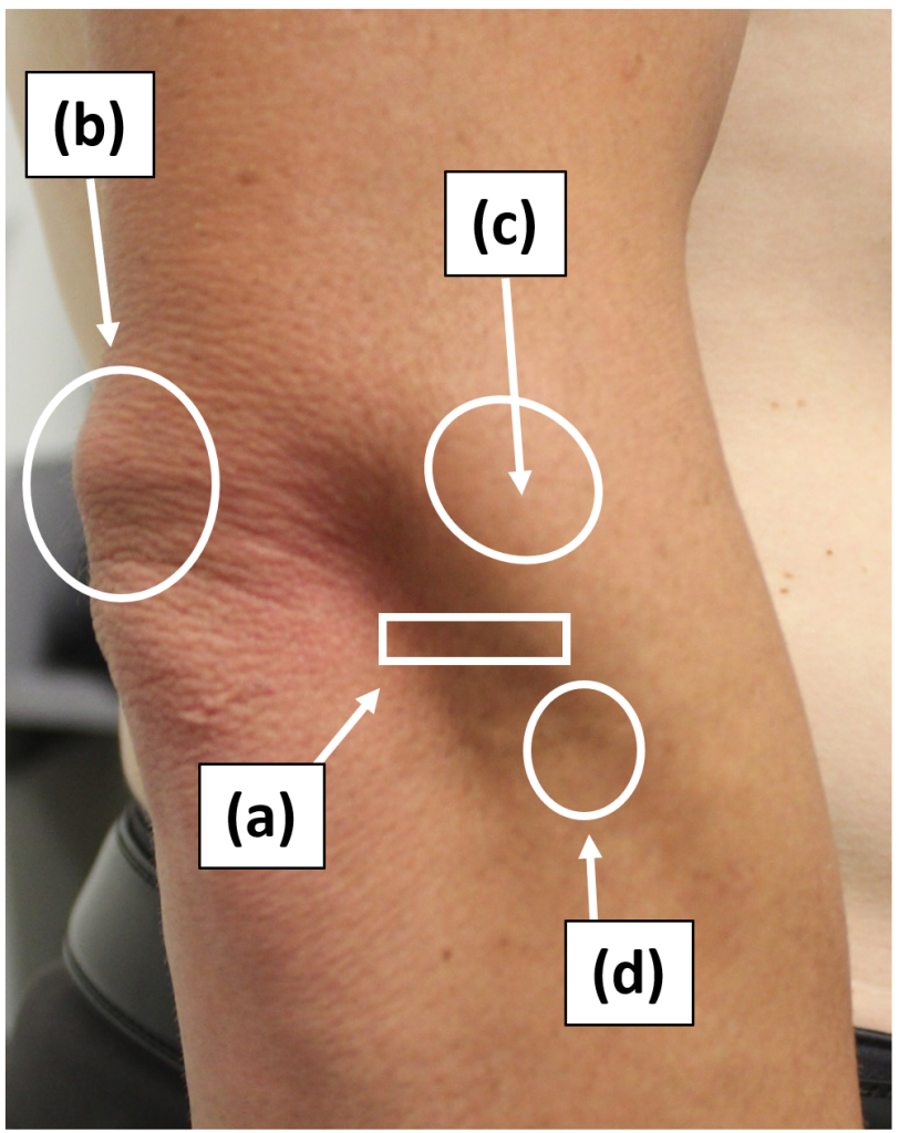 Right elbow– Lateral view