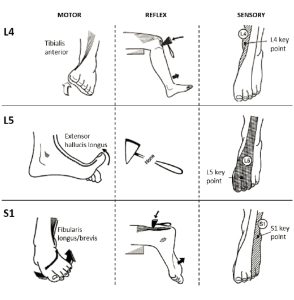 Motor, reflex and sensory information in lumbar radiculopathy at L4, L5, and S1 levels