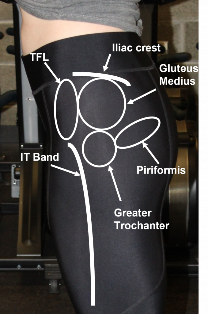 Left Hip–Lateral view