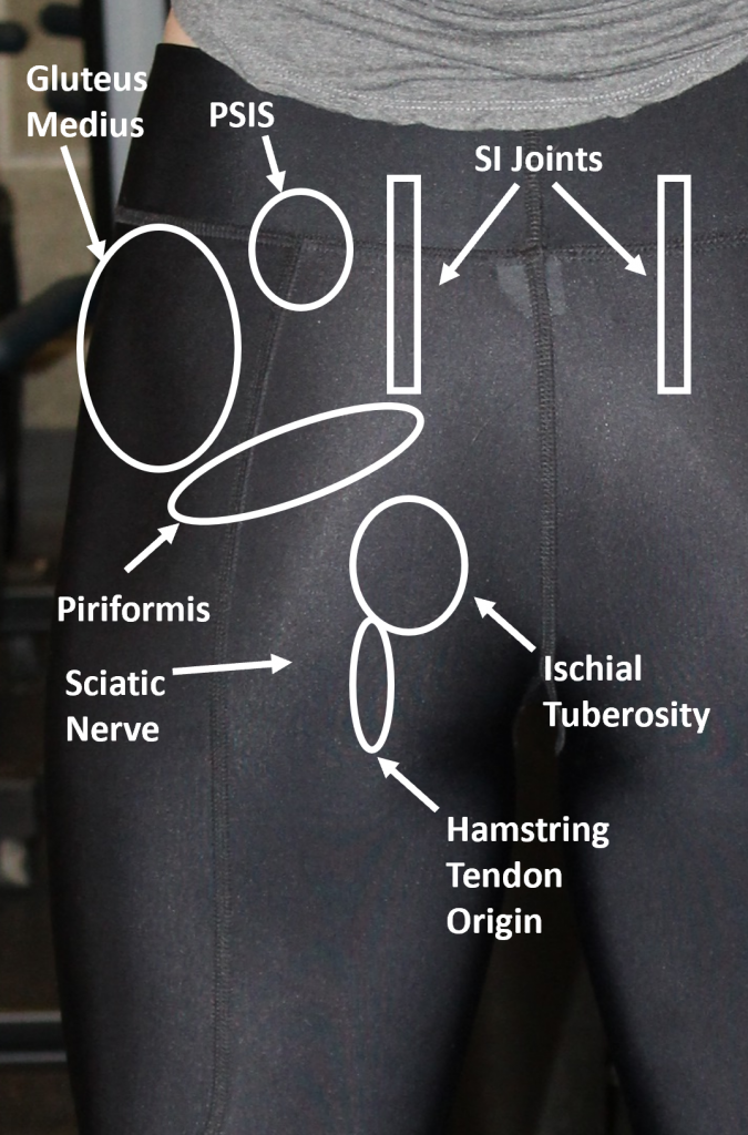 Left Hip–Posterior view