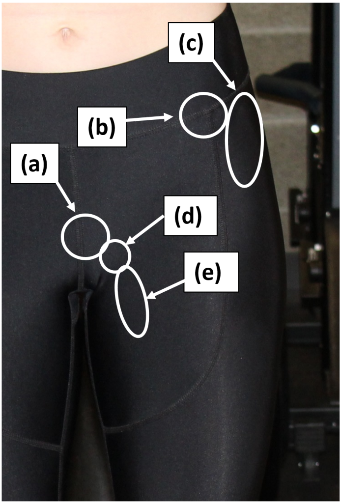 Left Hip– Anterior view