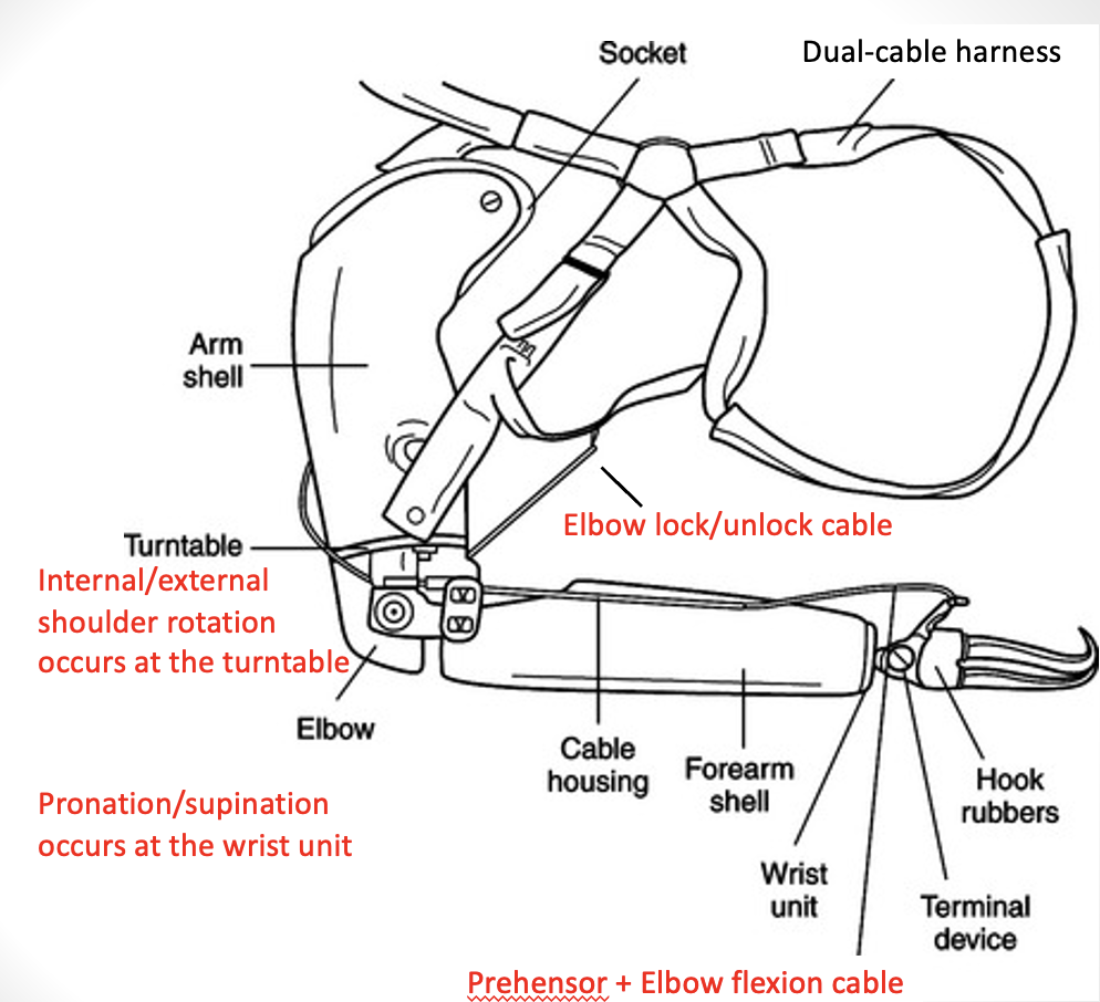 Transhumeral Suspension and Control – Upper Limb Prosthetics and ...