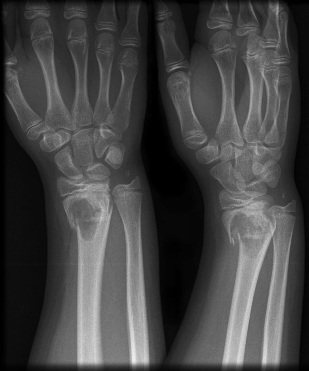 Cover image for Musculoskeletal Impairments